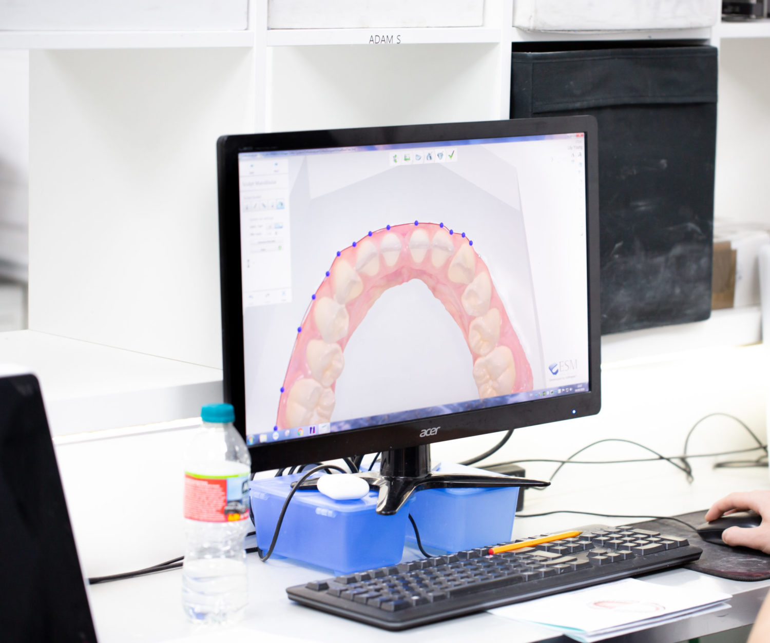 ALS acquires Leca Dental Laboratory ALS Dental