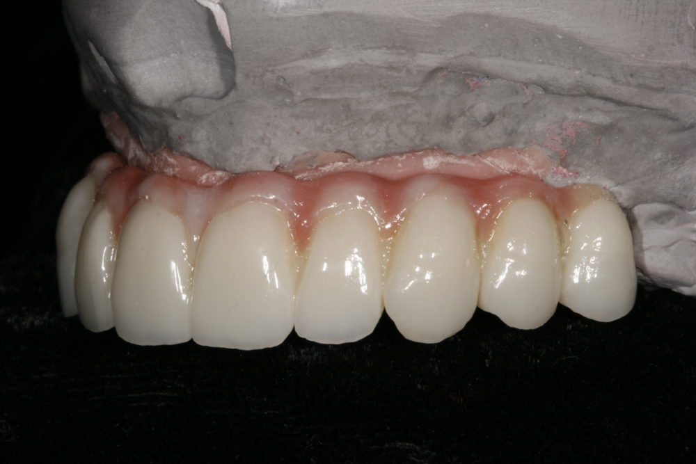 Halo Dental Joins ALS Dental Group ALS Dental