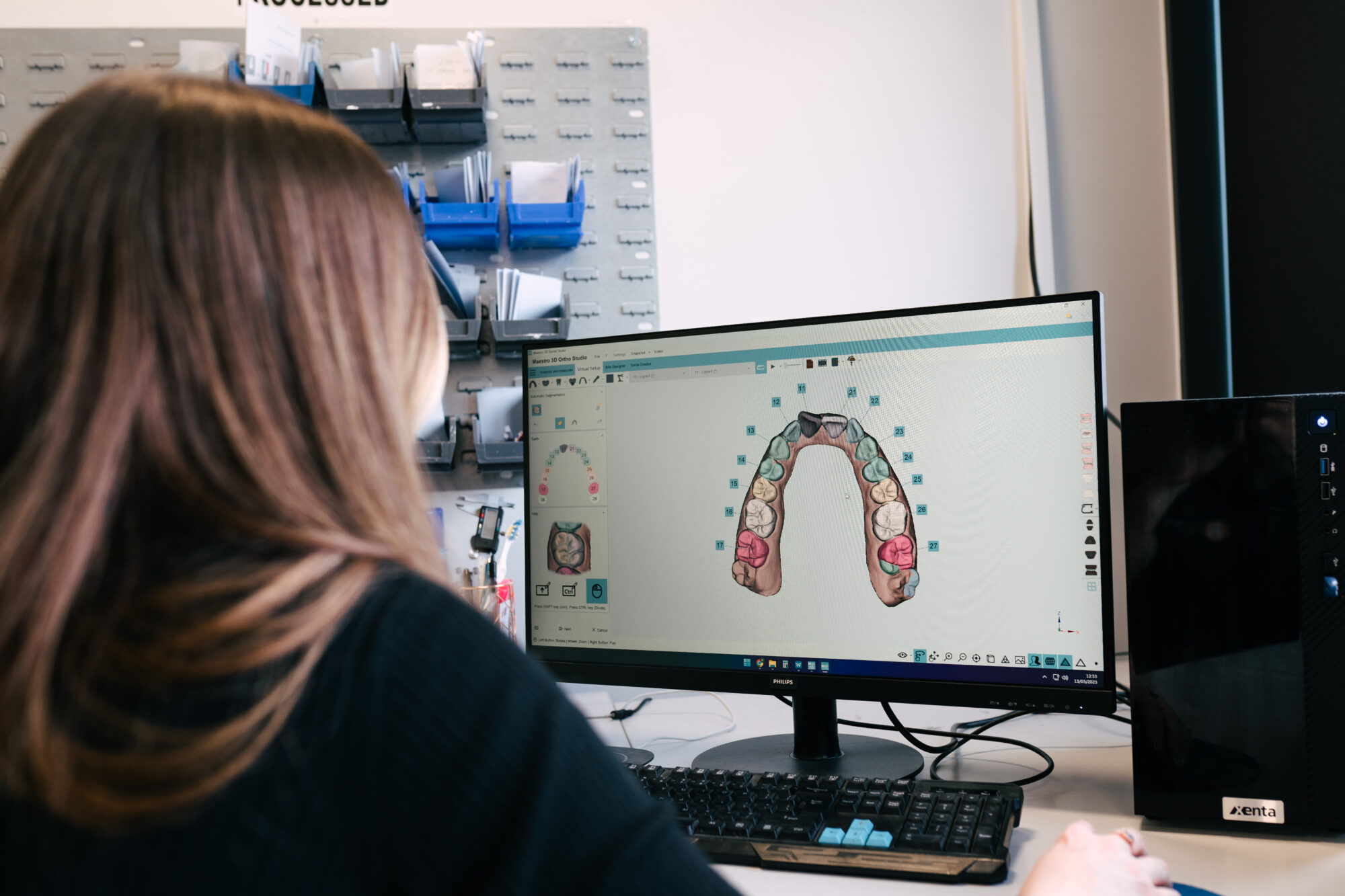 Dentures in just 2 appointments - ALS Dental