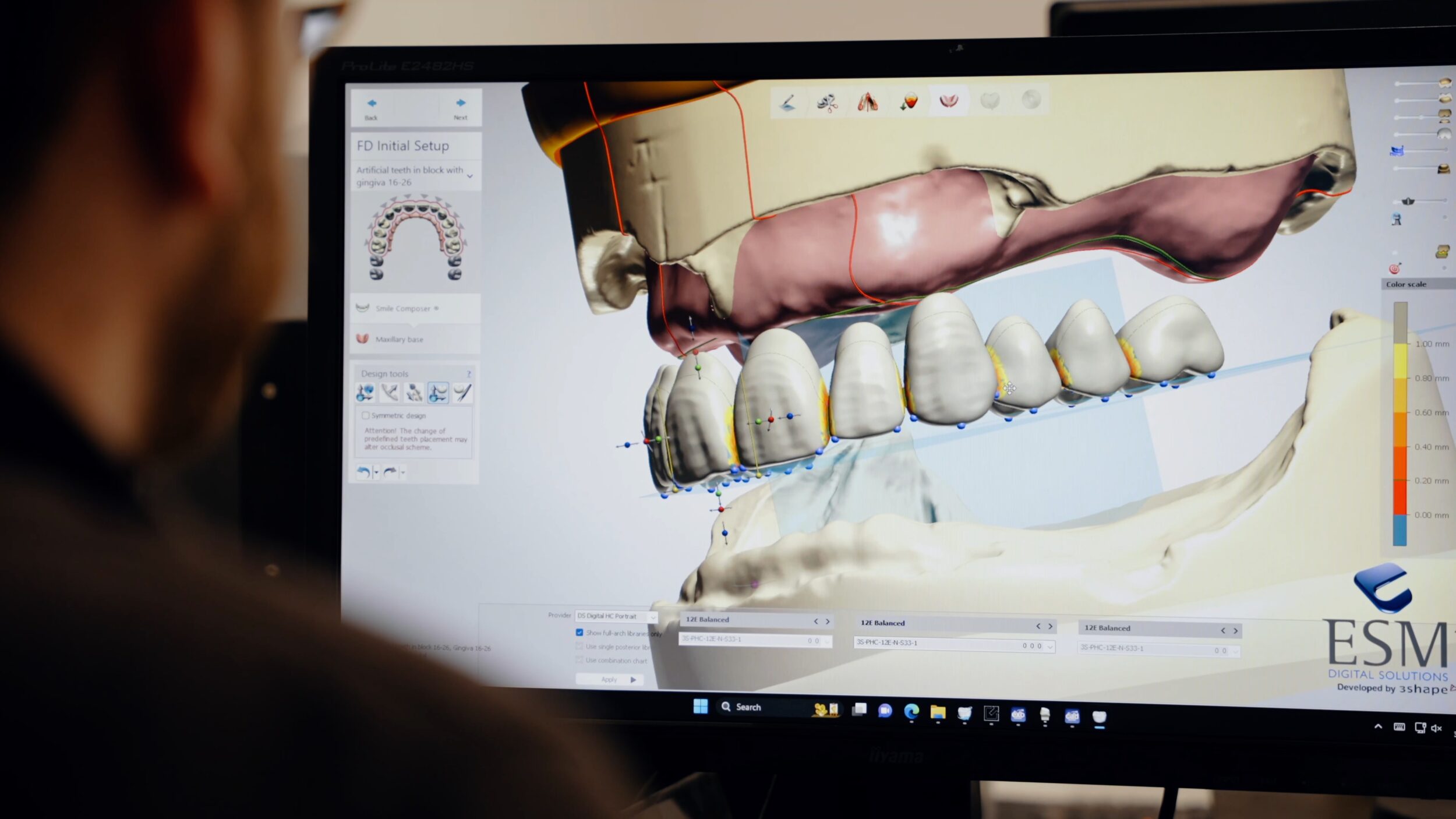 Photogrammetry - ALS Dental