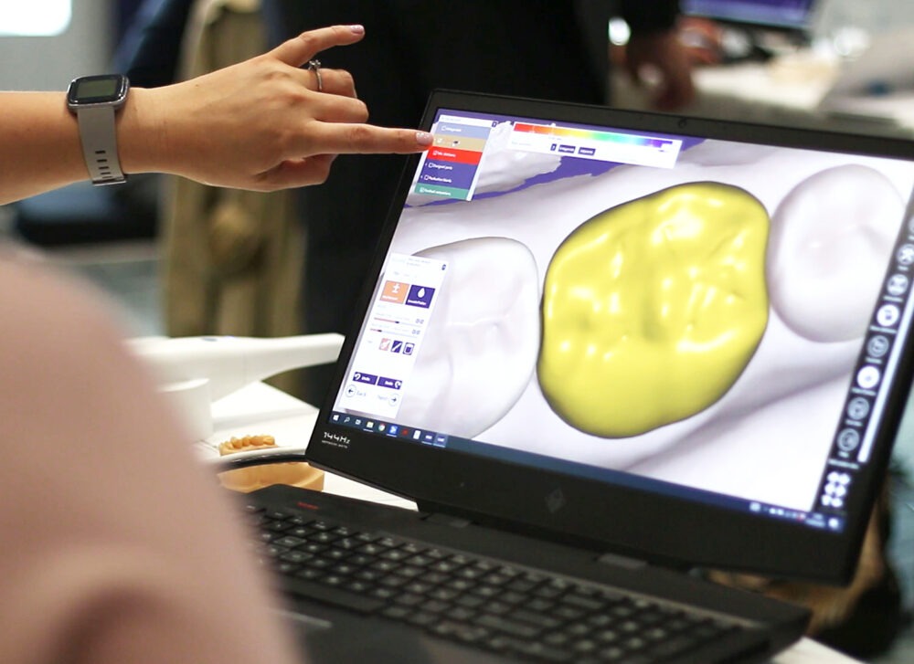 Bristol Cad/Cam | Dental Laboratory | ALS Group